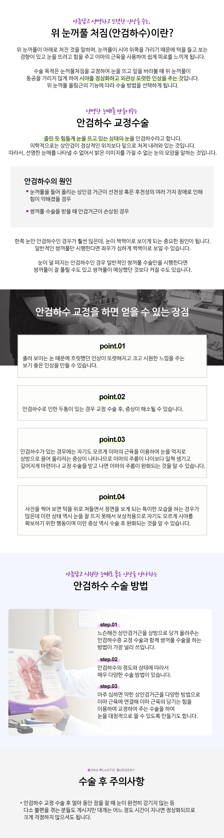 안검하수