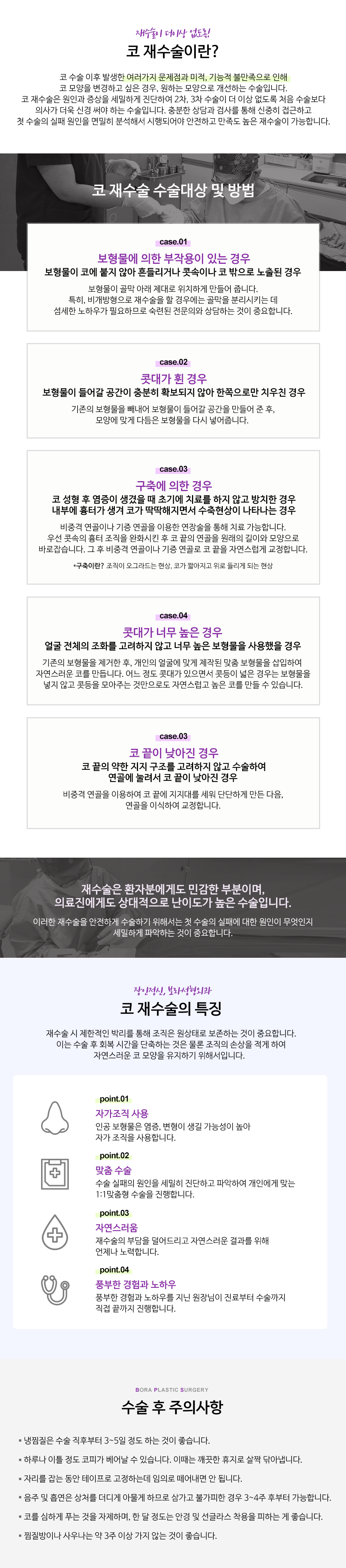 코재수술