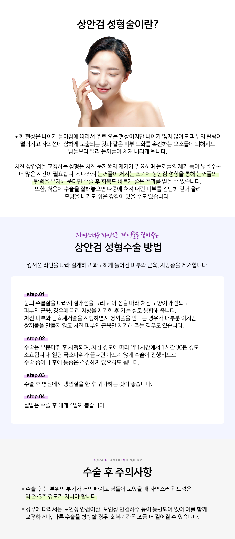 상안검