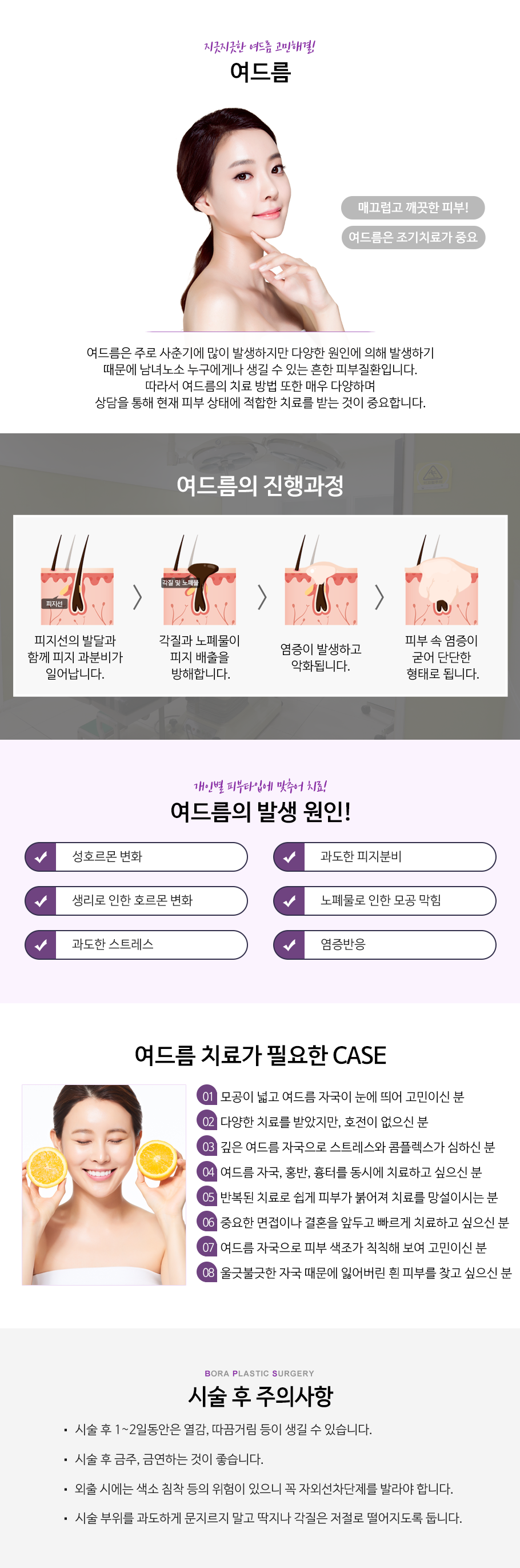 여드름