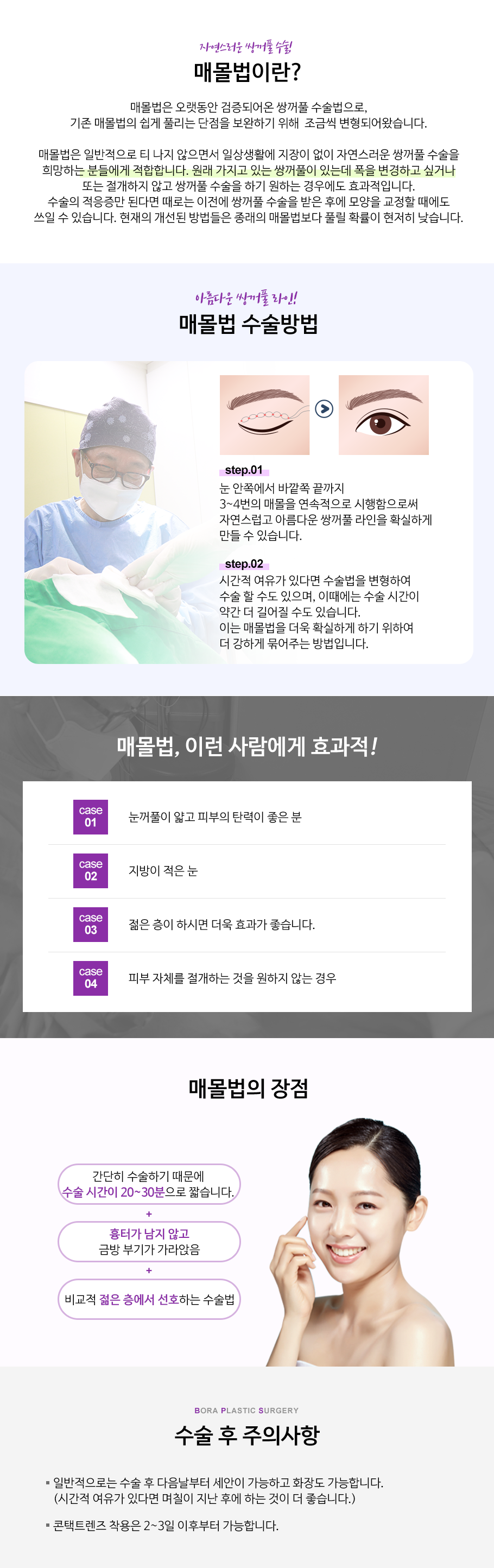 매몰법