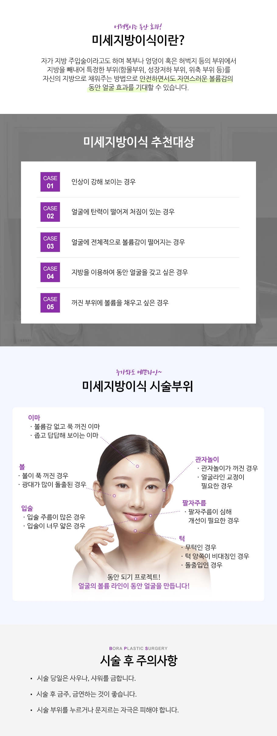 미세지방이식