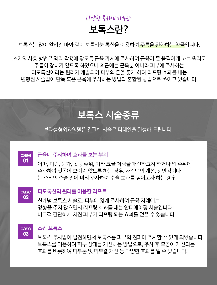 보톡스
