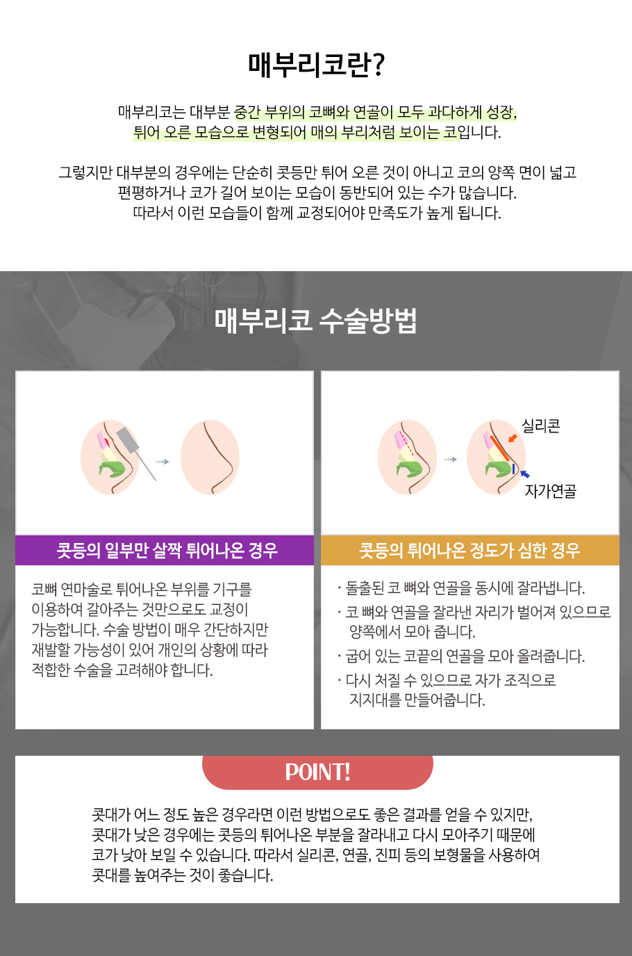 매부리코교정