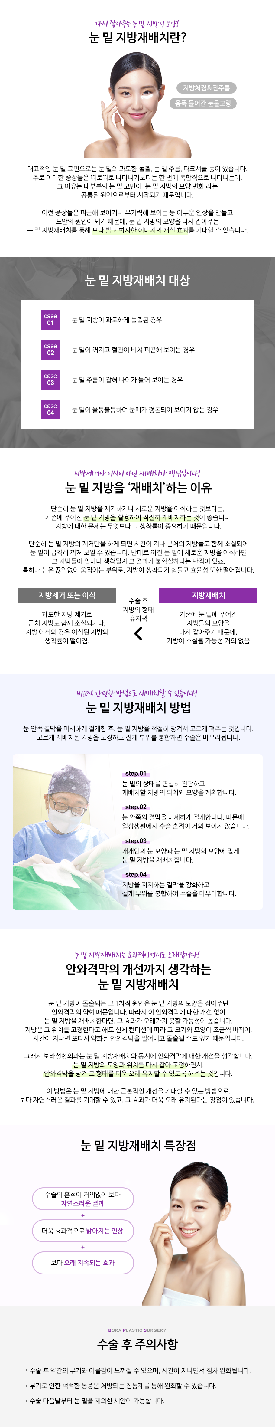 눈밑지방재배치