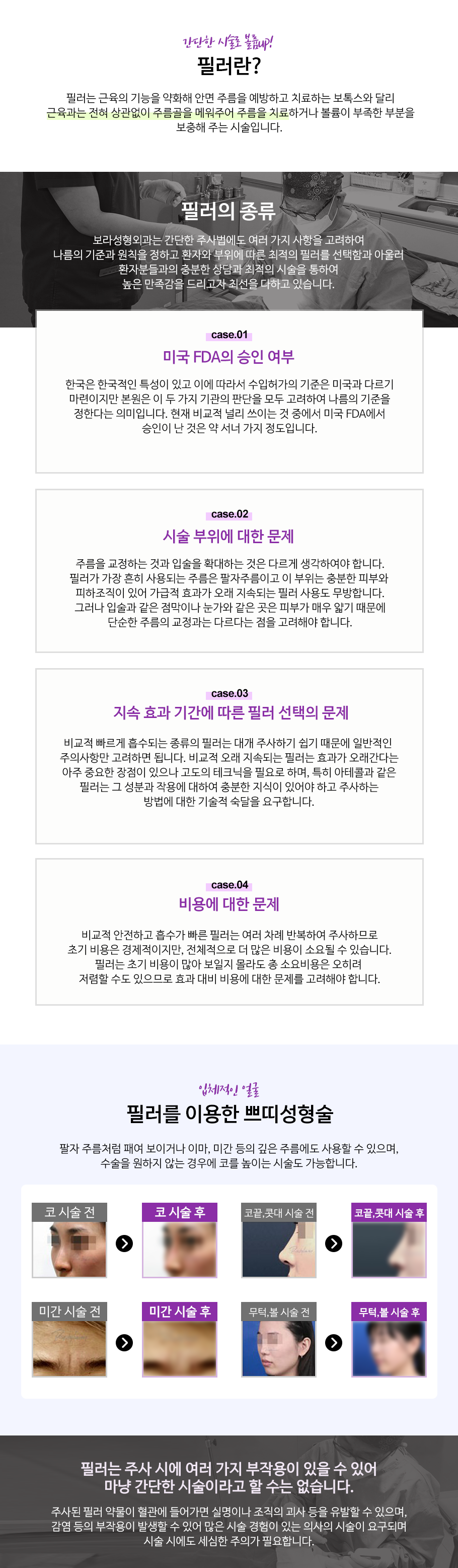 필러