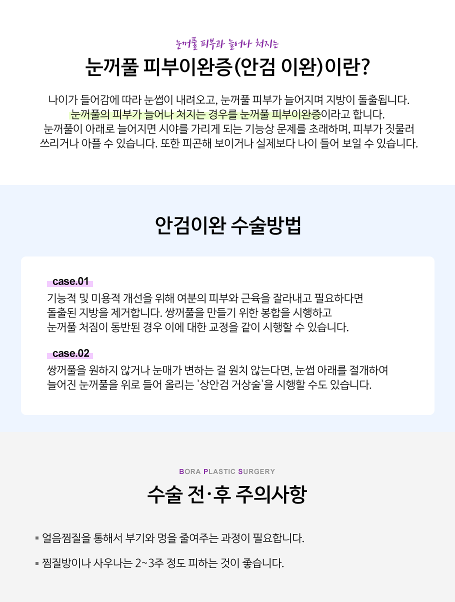 안검하수