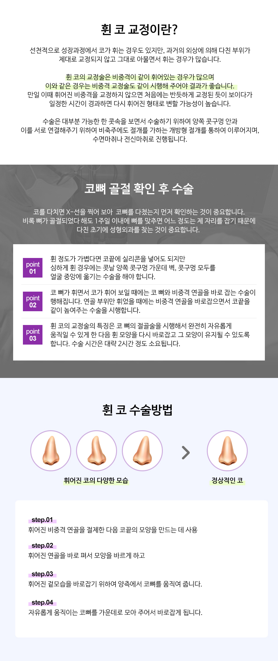 휜코교정