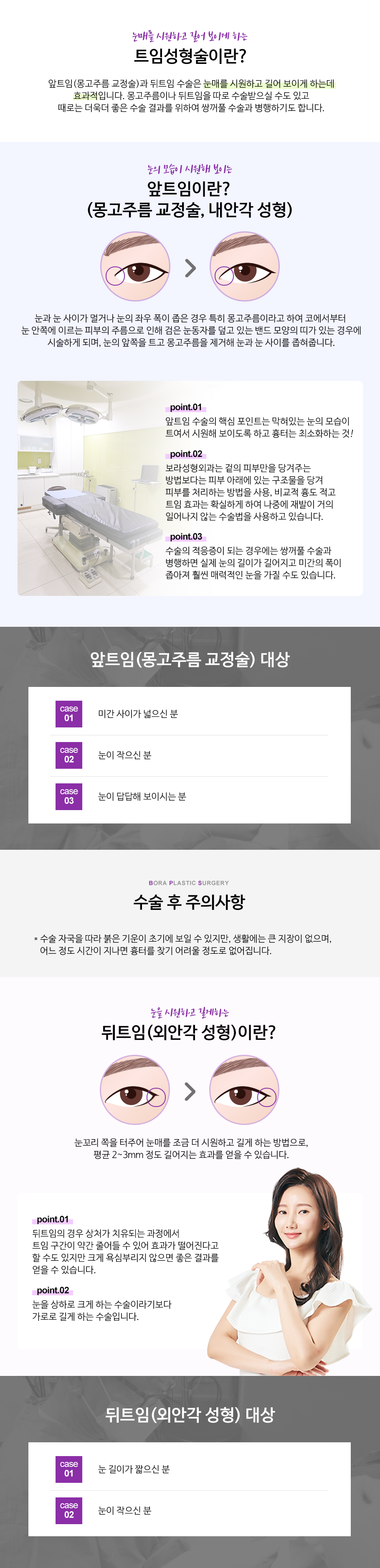 트임성형