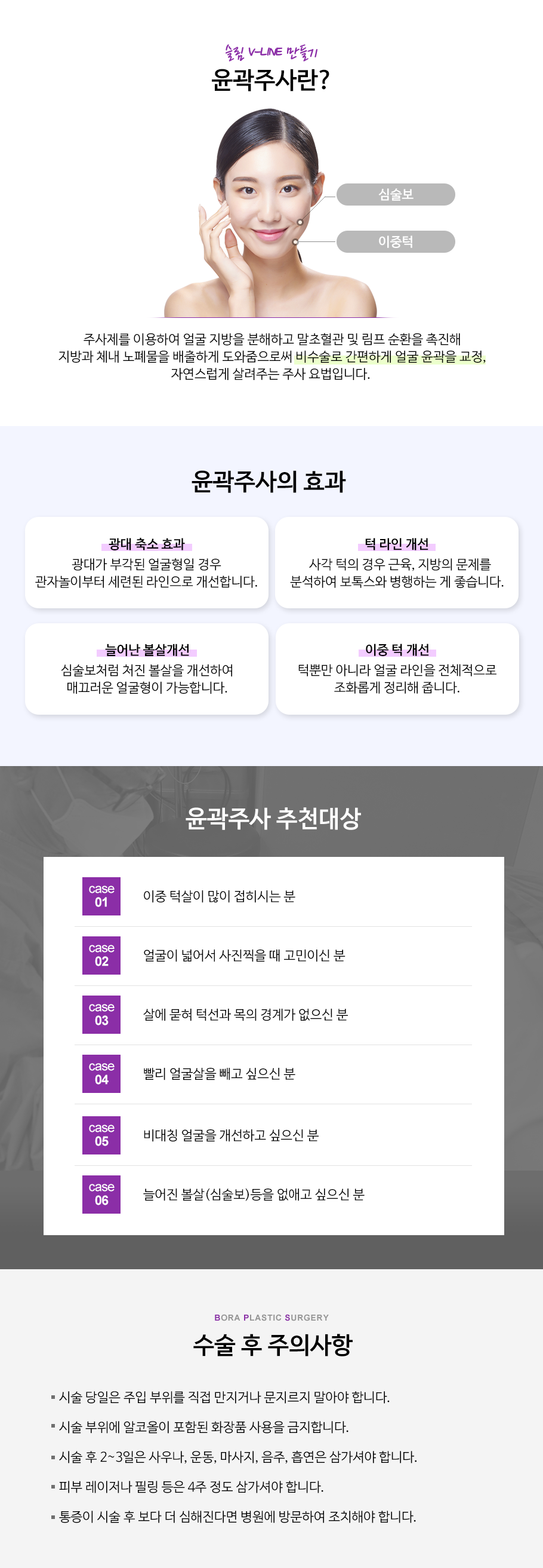 윤곽주사