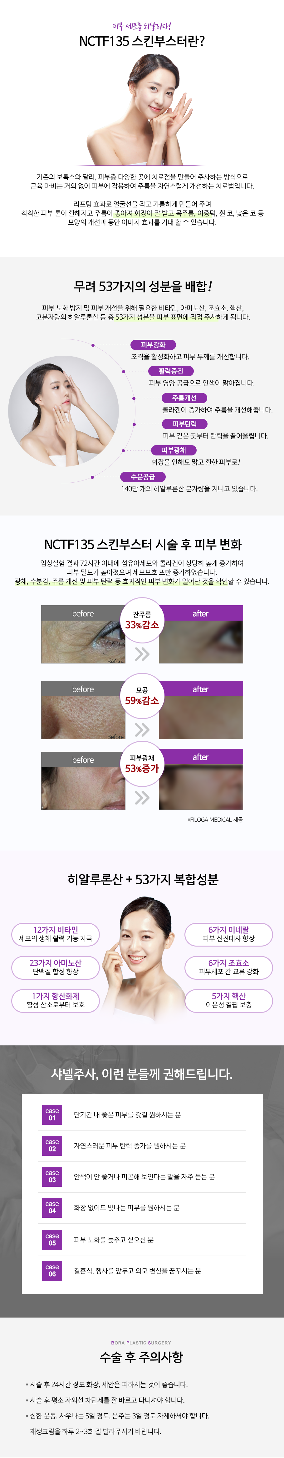 NCTF135 스킨부스터