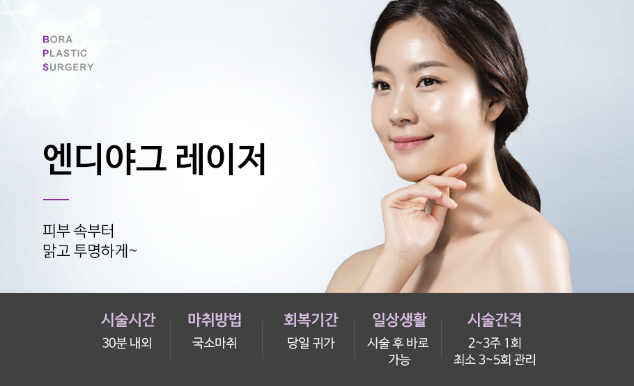 엔디야그