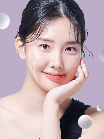 쁘띠성형<p>입체감 있고 <br> 세련된 얼굴라인!</p>